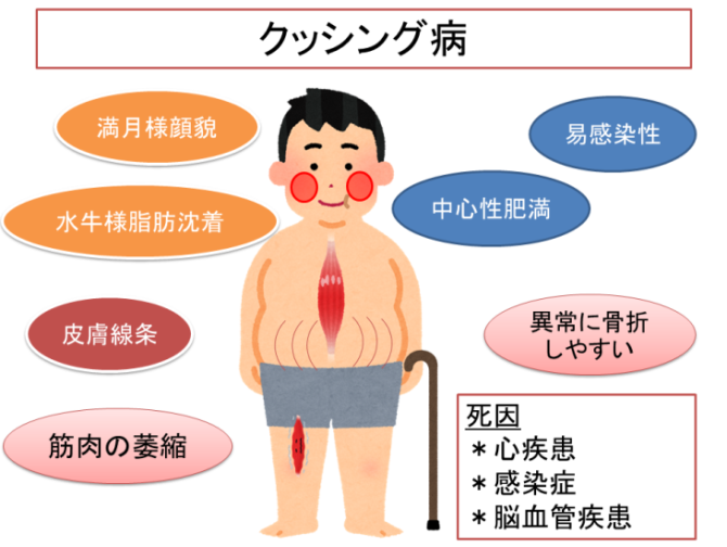 下垂体依存性クッシング病とは何ですか?